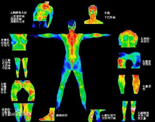 便携式医用红外热成像仪