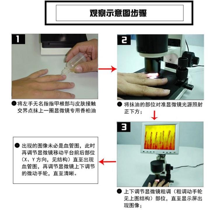 微循環(huán)血管流速檢測(cè)儀器 手指末梢血管觀察儀