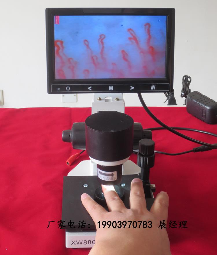 鄭州奧斯康微循環(huán)檢查儀分析儀無(wú)創(chuàng)