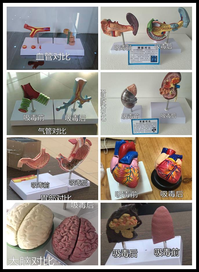 仿真器官对比模型 宣传教育模型 仿真器官对比模型教育